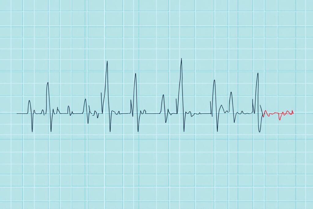 Kako očitati EKG nalaz tumačenje linija na elektrokardiogramu