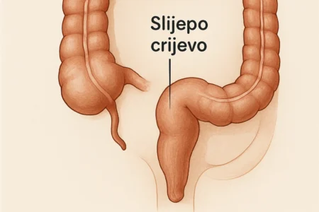 slijepo crijevo